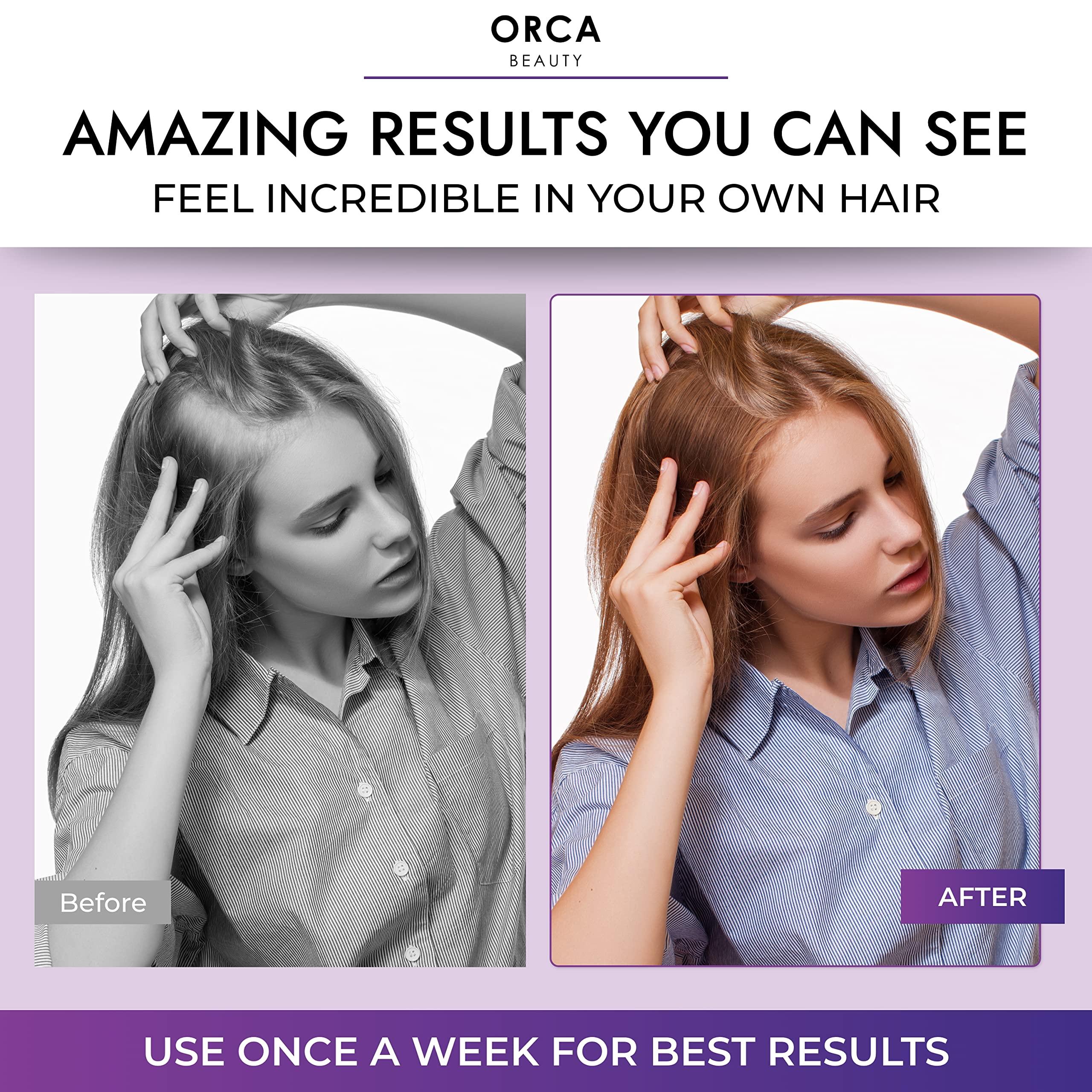 Orca Beauty Biotin Shampoo and Conditioner for Women and Men - Volumizing Shampoo and Conditioner Set to help boost thinning hair - Hydrating, Nourishing Hair Loss Shampoo and Conditioner