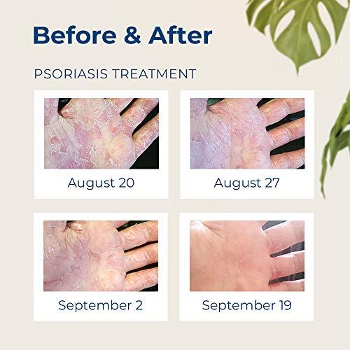 Gloves In A Bottle Gloves in a Bottle Shielding Lotion for Dry Itchy Skin Grease-Less and Unscented, 8 Fl Oz, Pack of 2