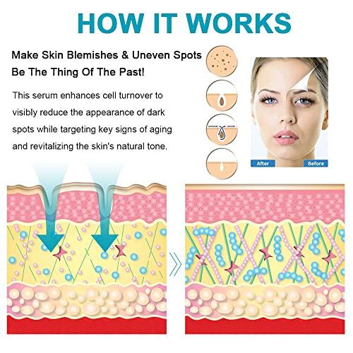 SWETIYOU Dark Spot Remover for Face, Fast-Acting Dark Spot Corrector Remover for Face and body Hyperpigmentation, Fades Melasma, Freckle, Sun Spots, Evens Skin Tone, Age Spot Remover for Women Men