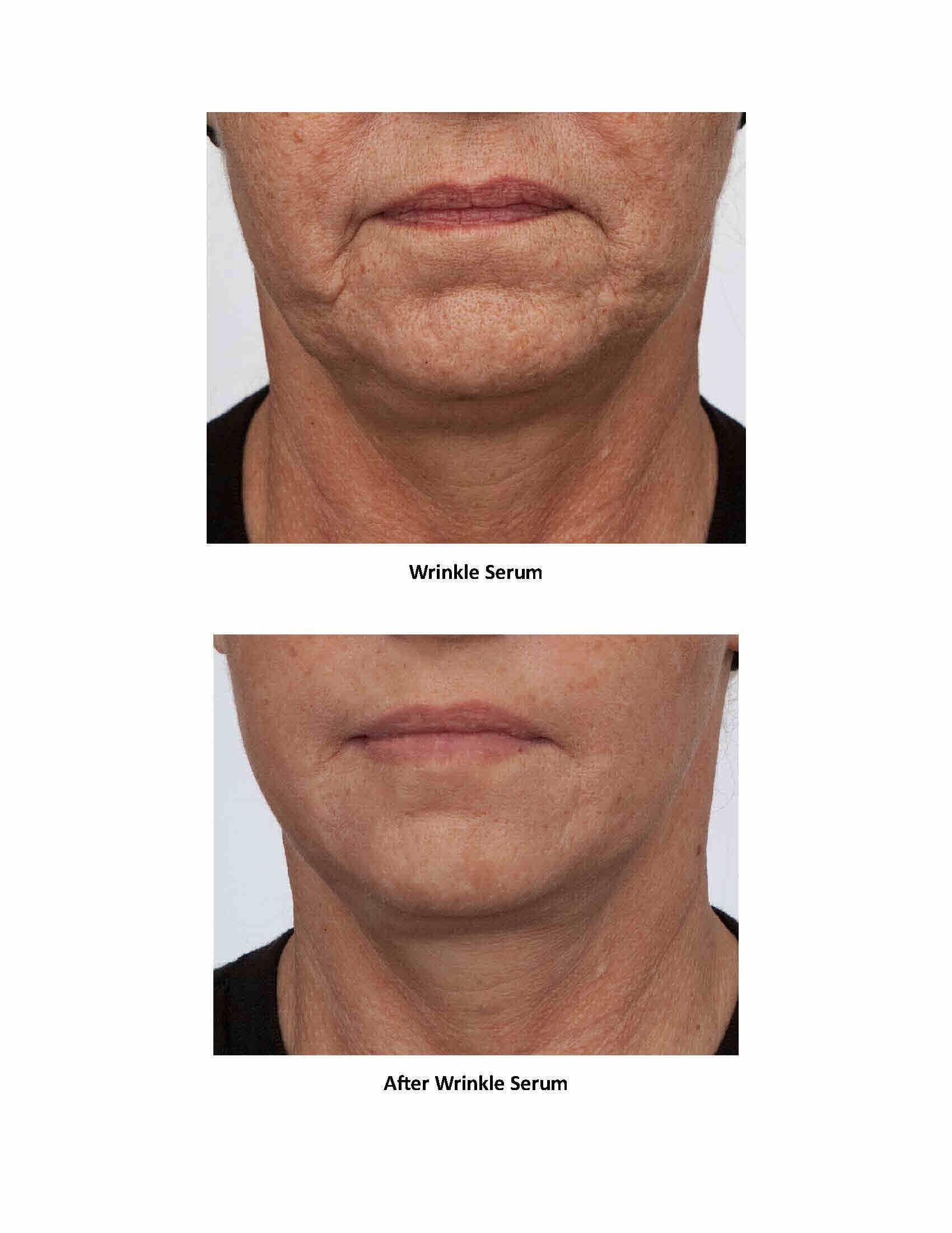 Dr.Sevinor Skincare Solutions Dr Sevinor Genuine Wrinkle Solution Wrinkle Smoothing Tinted Serum and Dr. Sevinors NEW Genuine Facelift Solution Concentrated Serum Invigorates Tired Looking Skin, Diminishes Wrinkles/Lines