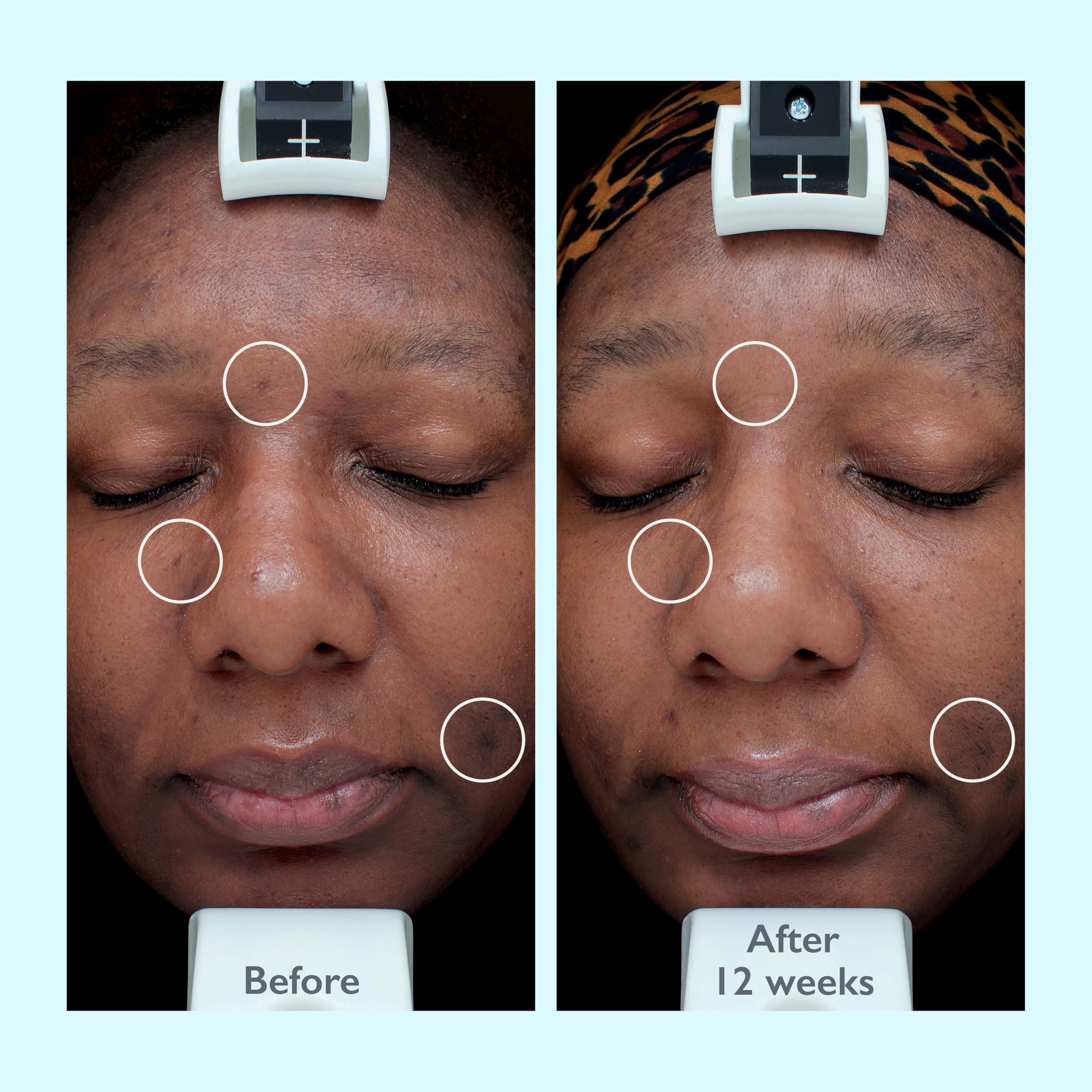 bravechichi Restørsea PRO Intensive Treatment 10X