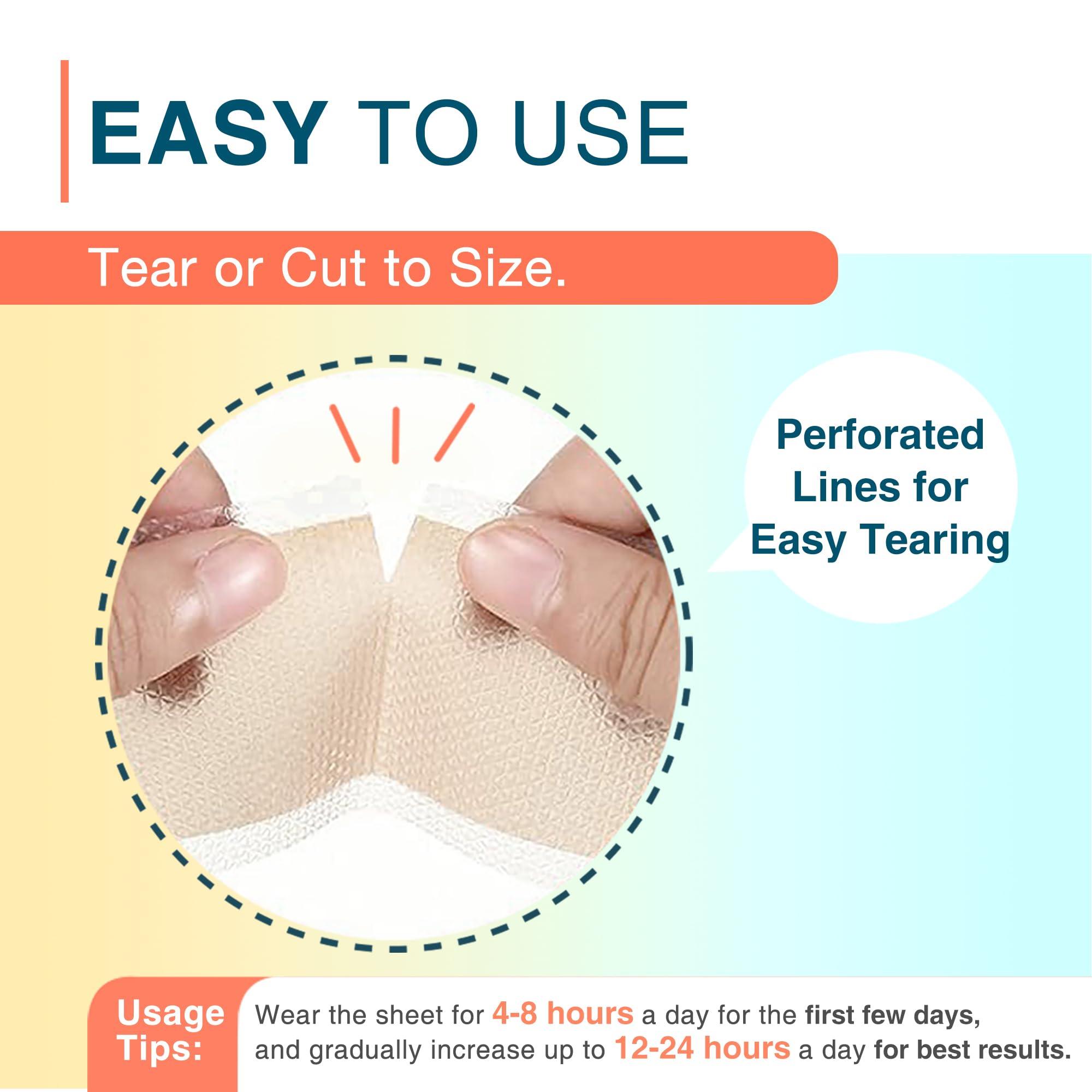 MEDLOT MEDLOT Silicone Scar Sheets, 1.5 x 156 Medical Silicone Scar Tape Roll, Reusable Scar Strips for Surgical, C-Section, Keloid Bump, Stretch Marks, Acne, Hypertrophic Scar Treatment