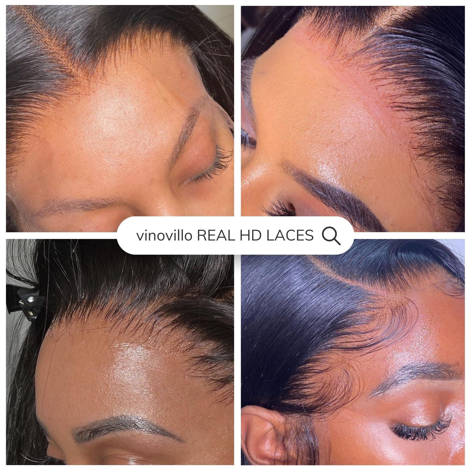 vinovillo VINOVILLO 13x4 Skinlike Real HD Lace Frontal Only Straight Ultra Thin Invisible Lace Virgin Human Hair Front Pre Plucked Natural Hairline Sew In Frontal Closure Piece 18 Inch Natural Black