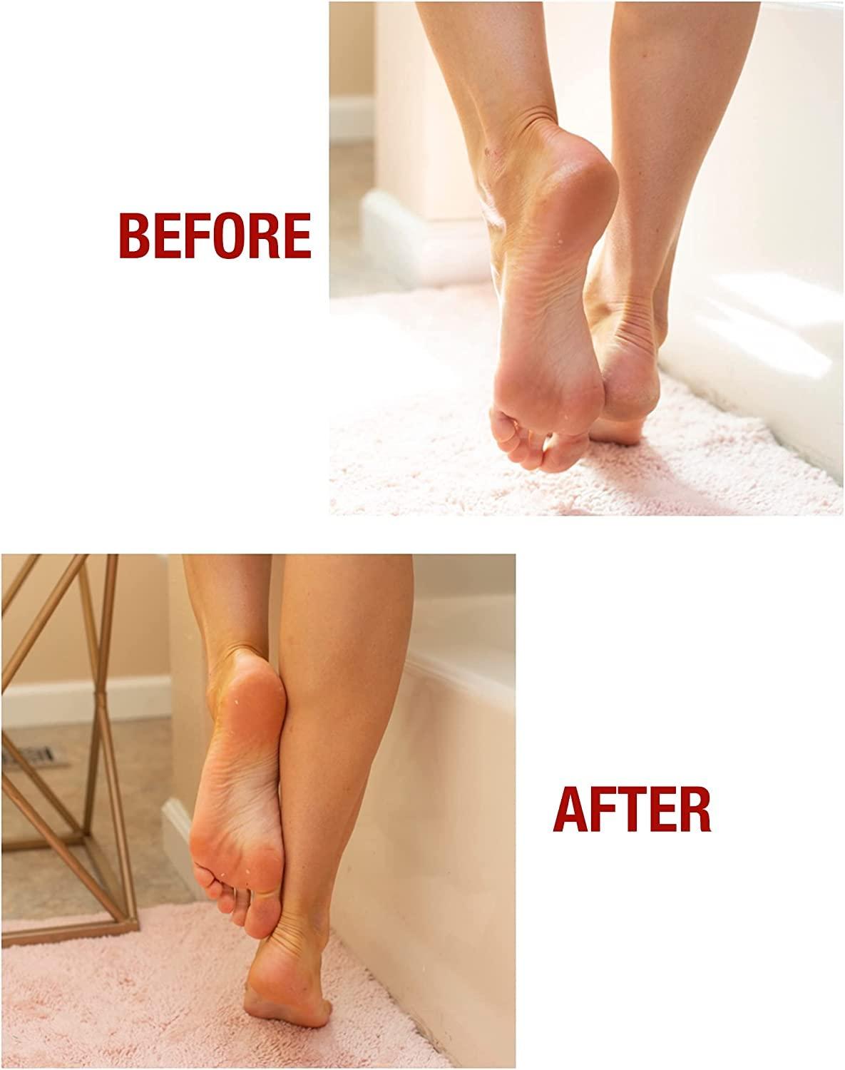 Kerasal Kerasal Intensive Foot Repair Skin Healing Ointment, 1 Oz and Zen Toes Moisturizing Gel Socks, One Pair