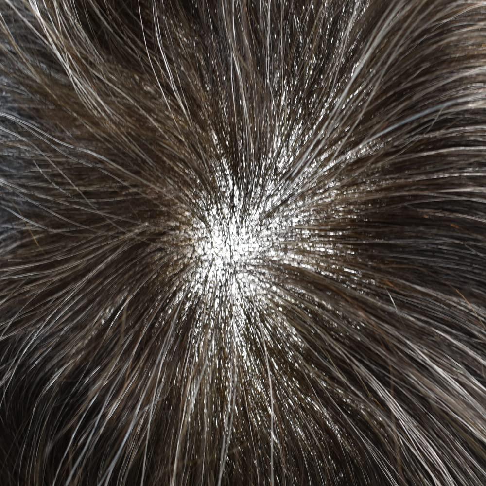 DR Hair Toupee For Men Hair System French Lace Real Human Hair Replacment System Lace Front Blached Knot Mens Toupee Hair Pieces Nantural Hairline8x10 light to Medium density#240 2# DARKEST BROWN+40% GREY