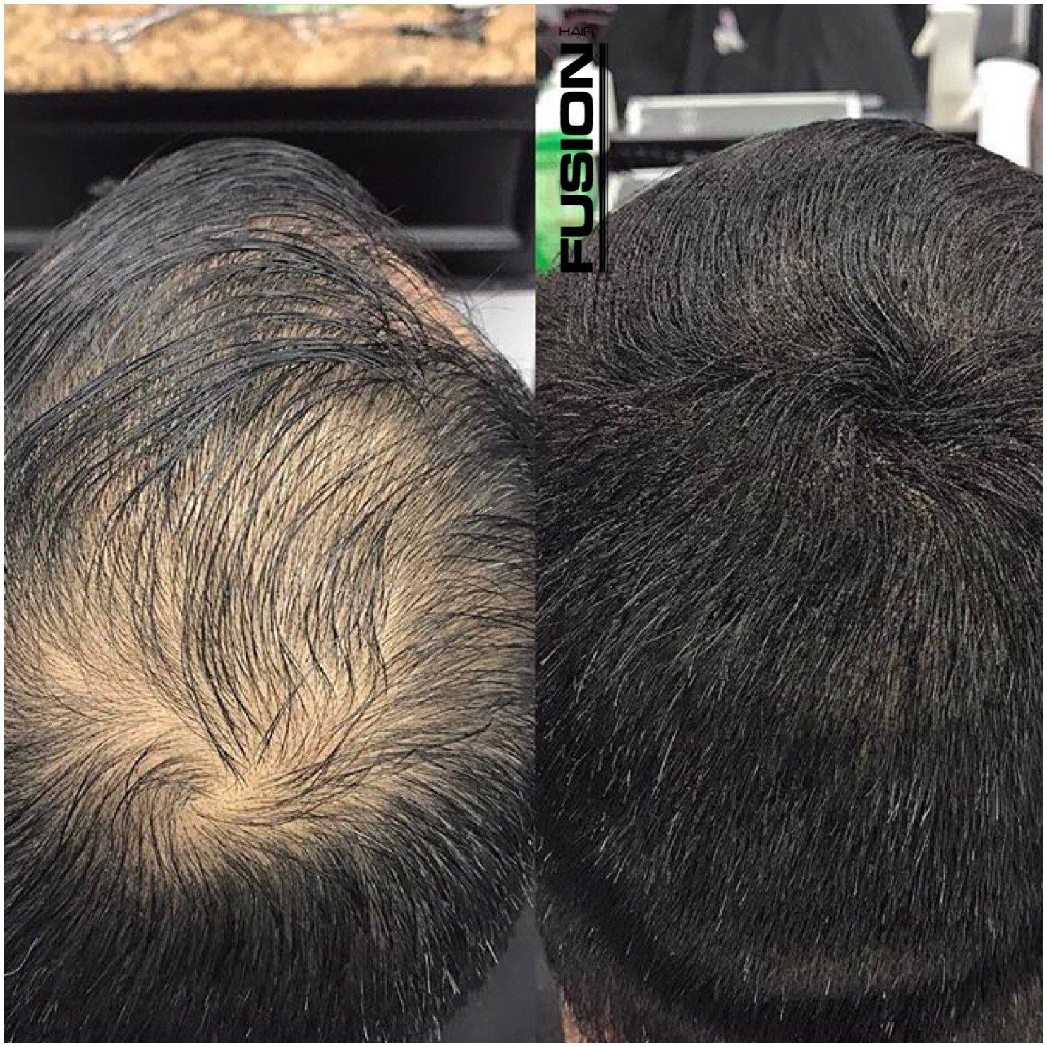 Hair Fusion Hair Fibers for Thinning Hair - (1.05 Oz) Real Human Hair Building Fibers to Conceal Bald Spots and Thinning Hair, Root Touch Up and Volumizer, Brown