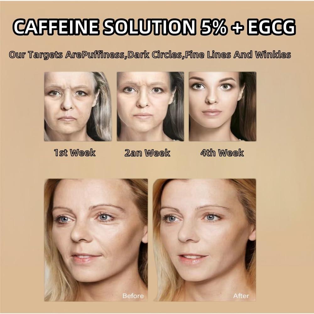 AFCRYIYE Caffeine Solution 5% + EGCG, Caffeine Eye Serum For Face, Moisturizing Under Eye Solution For Reduces Dark Circles & Puffiness, 30ML (1, 1 PC)