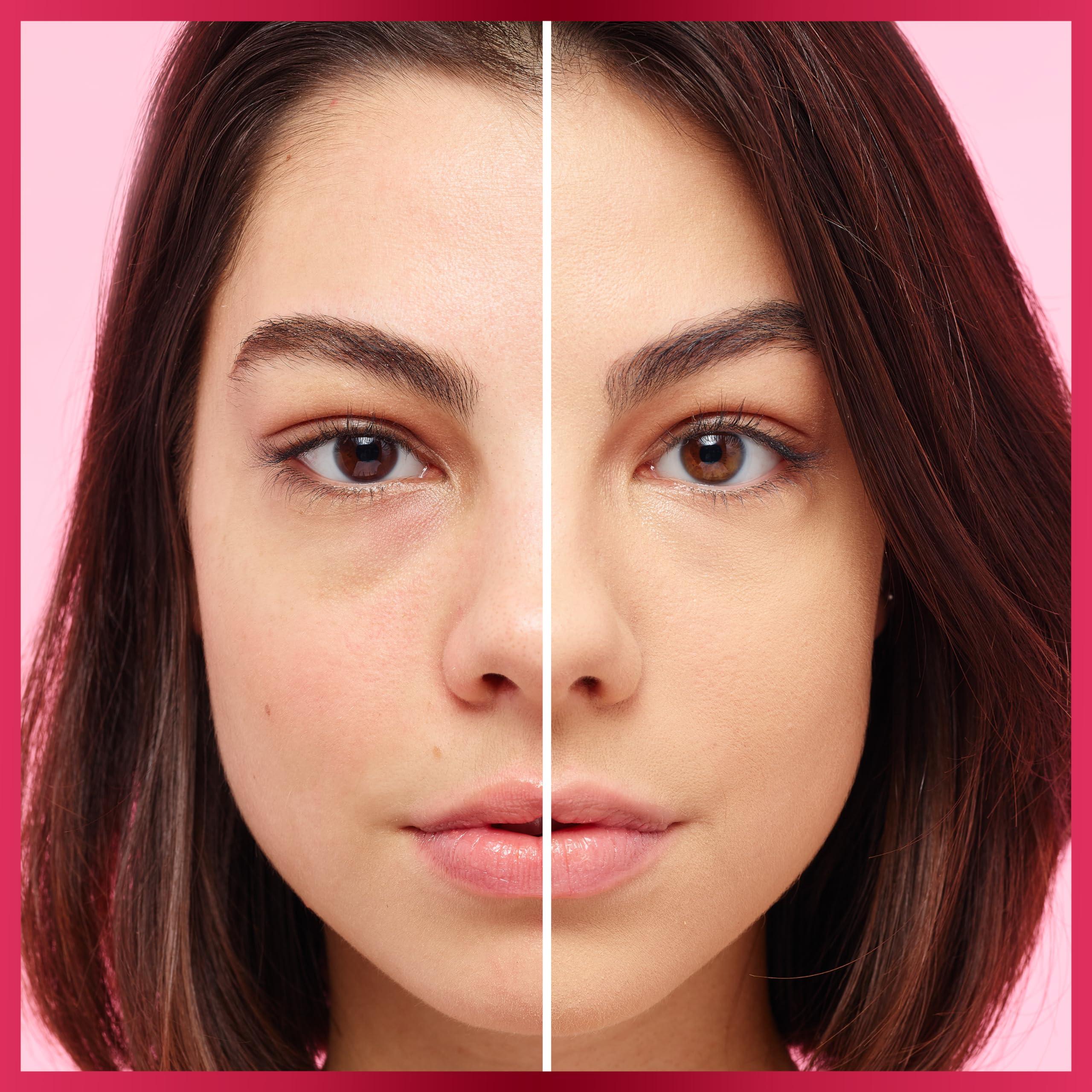 Olay Wrinkle Cream by Olay Professional Pro-X Deep Wrinkle Treatment Anti Aging 1.0 Fl Oz (Packaging may vary)