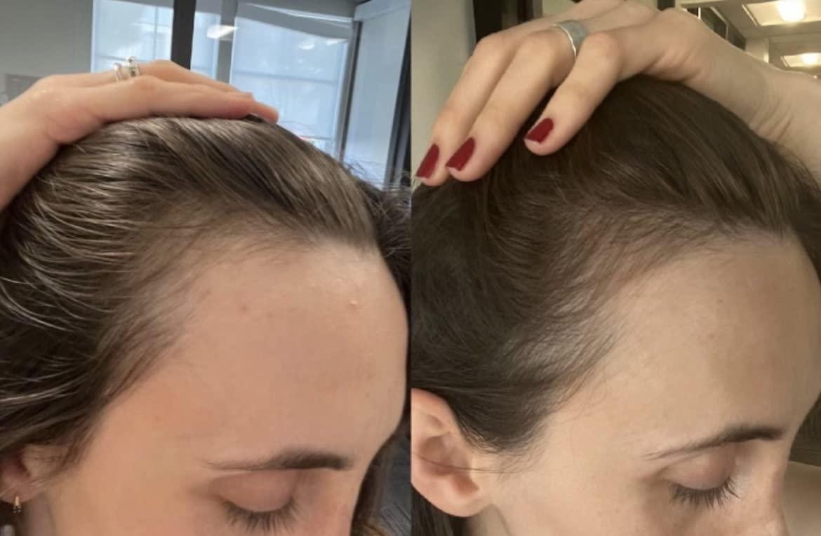 Bur Bur BUR BUR Growing Season Hair Growth And Repair Oil | With Burdock, Nettle Oil and Vitamin C for Visibly Fuller, Stronger and Shinier Hair.
