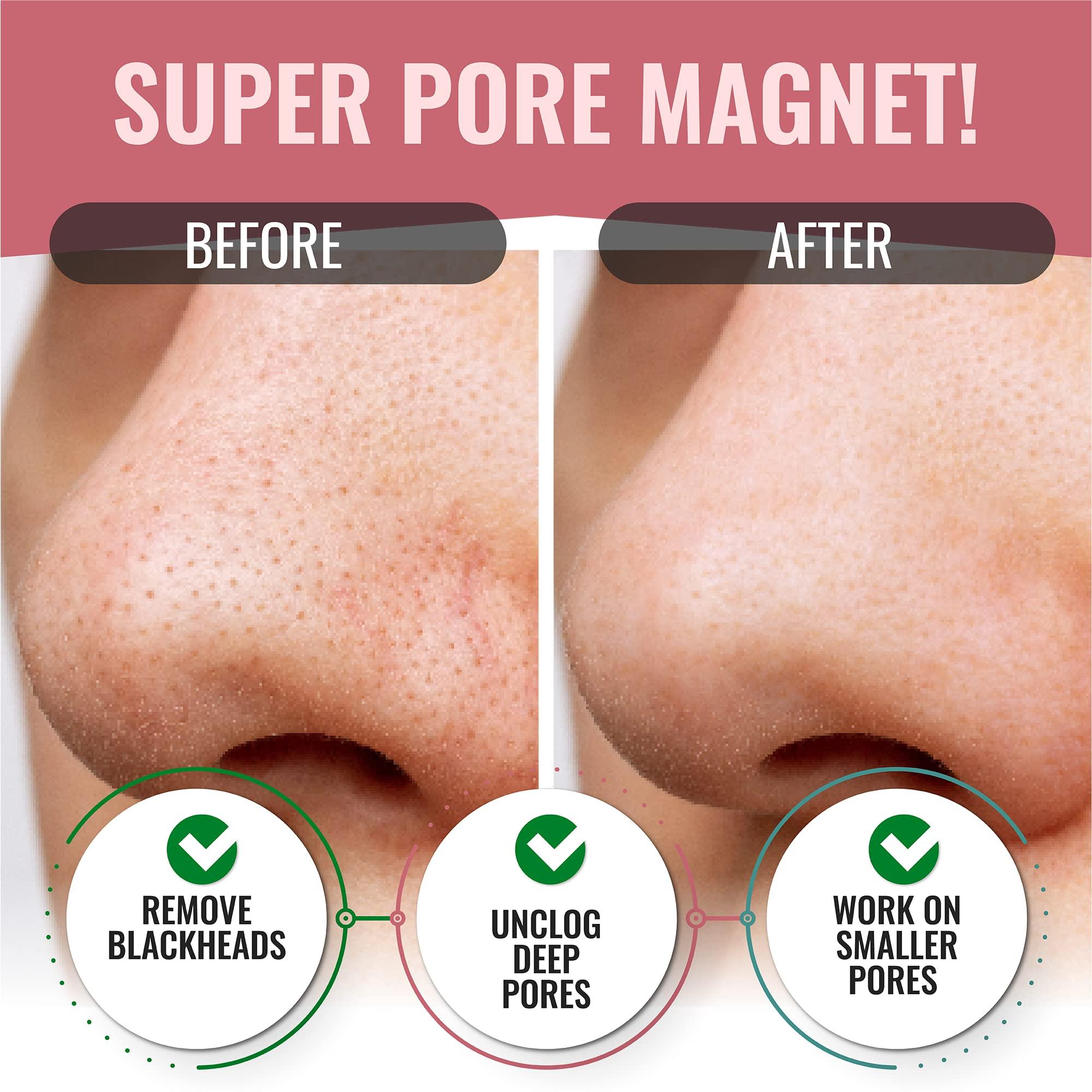 LOOKATME LOOKATME Nose Pore Strips (4-Pack, 20 Nose Strips). Korean Skin Care Blackhead Remover. K Beauty Blackhead Strips for Nose and Face, Black Head Strips Women. Acne Mask for Blackhead Removal. (Combo)