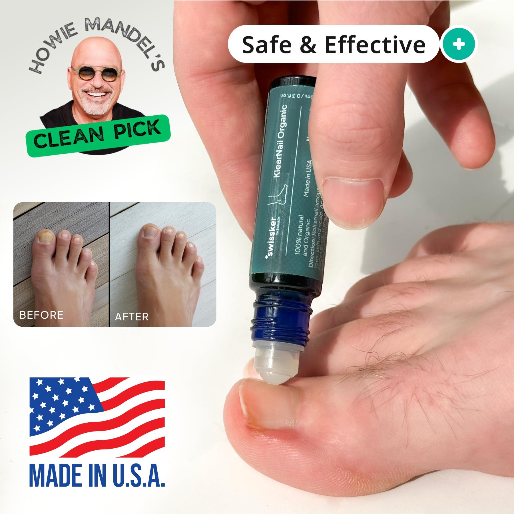 Swissklip Swissklip Medi-Care Toenail Stick I Natural Solution for Healthy Nails I Suitable For Foot, Toe, and Fingernail I For Brittle Toenails 10ml / 0.3 Fl. Oz. Pack of 1 - Made in USA