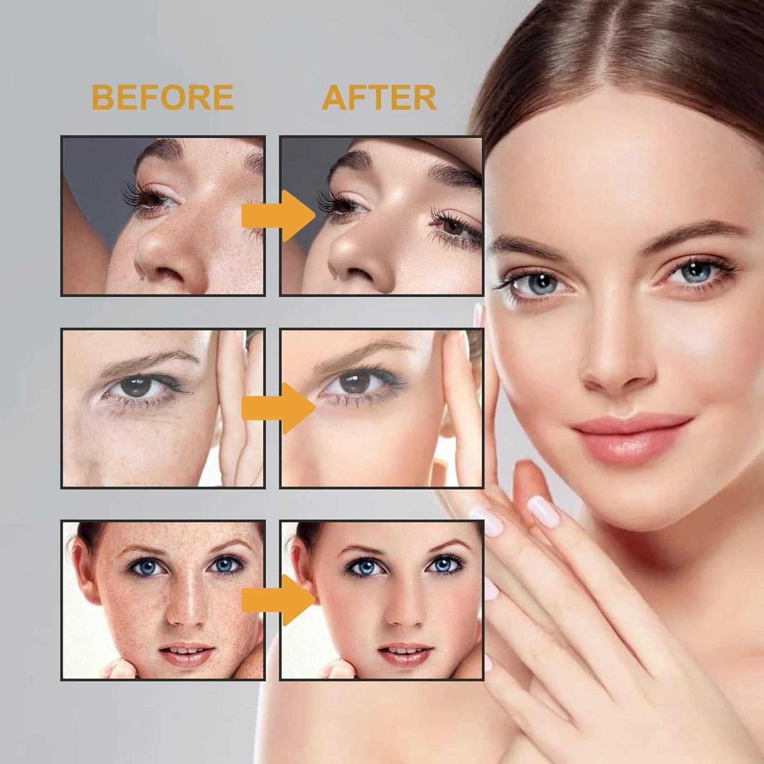 HEKEWER 2024 New Face Cream,Renewal Face Cream, Cosmetic Cream, Moisturizer Face Cream for Dry & Sensitive Skin (1PCS)