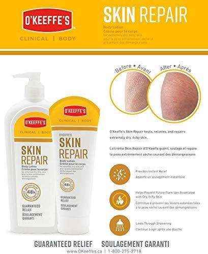 O'Keeffe's O'Keeffe's Skin Repair Body Lotion: 7 oz. Tube (Yellow)