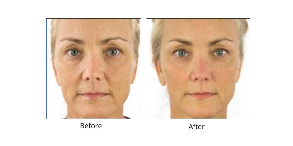 Dr.Sevinor Skincare Solutions Dr Sevinor Genuine Wrinkle Solution Wrinkle Smoothing Tinted Serum and Dr. Sevinors NEW Genuine Facelift Solution Concentrated Serum Invigorates Tired Looking Skin, Diminishes Wrinkles/Lines