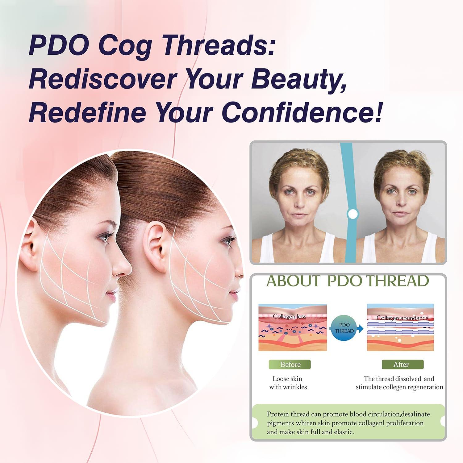 Habodd Pdo Cog Threads 19G100MM, Cog Threads Face Lift Bullet Blunt 10Pcs Pdo Threads Lift for Face/Body 360R Bi-direction Barb Lifting Cog 6D Type