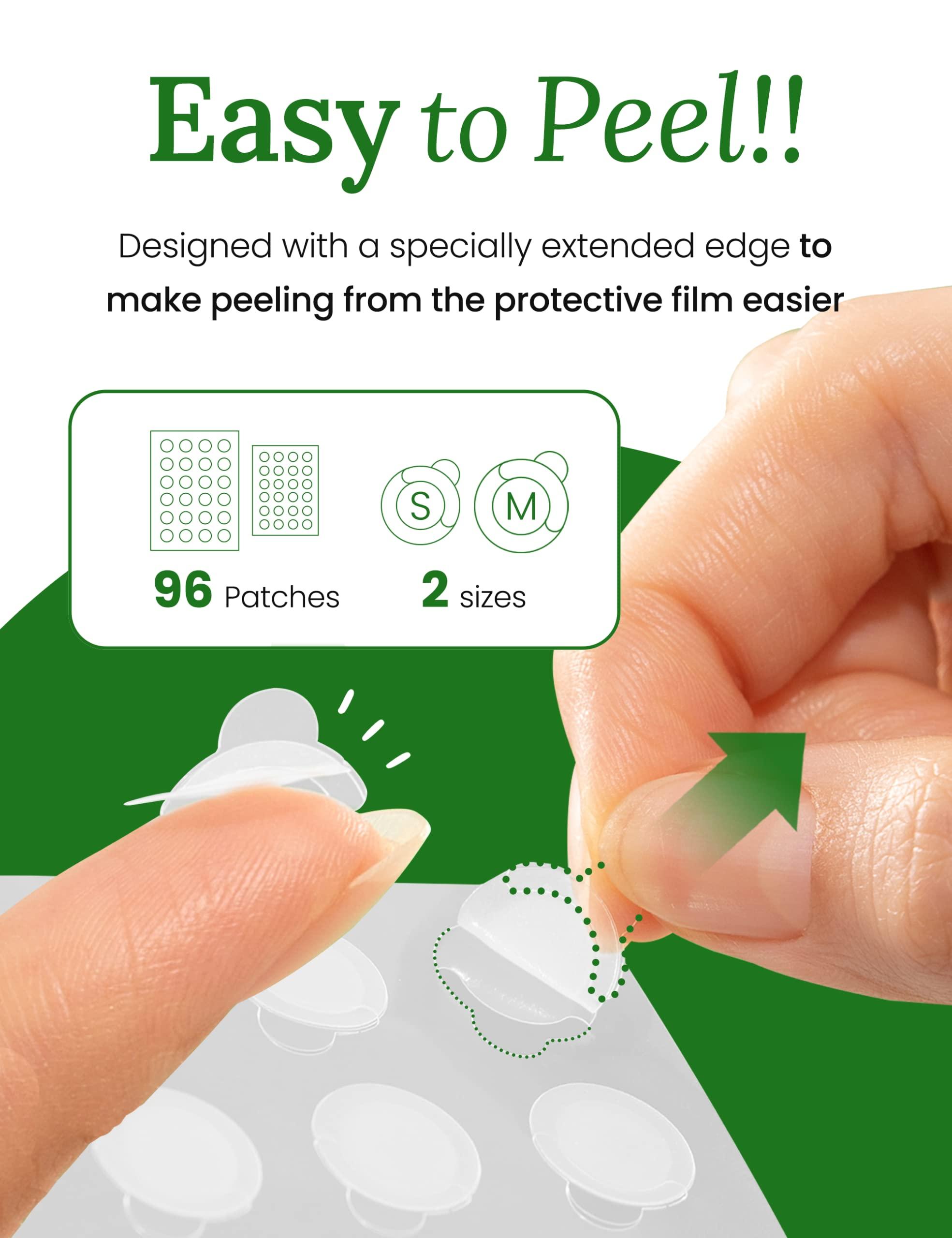 Troubless Troubless Invisible Pimple Spot Patch - Classic, Hydrocolloid Acne Patches for Face | Ultra Thin Acne Patches with Easy Peel Handle | Overnight Pimple Patches | 2 Sizes, 96 Count (Pack of 1)