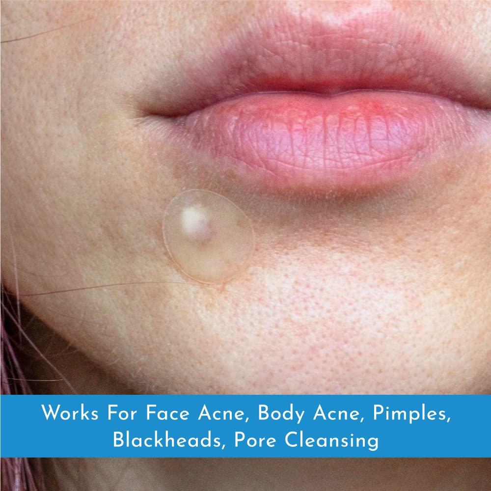 Truly Clear Truly Clear Hydrocolloid Acne Pimple Patches for Face & Body - 72 Count, Ideal for Cystic Acne, Zit & Blemishes - Cruelty Free Acne Dot, Spot Stickers, Acne Cover Patch - Overnight Results