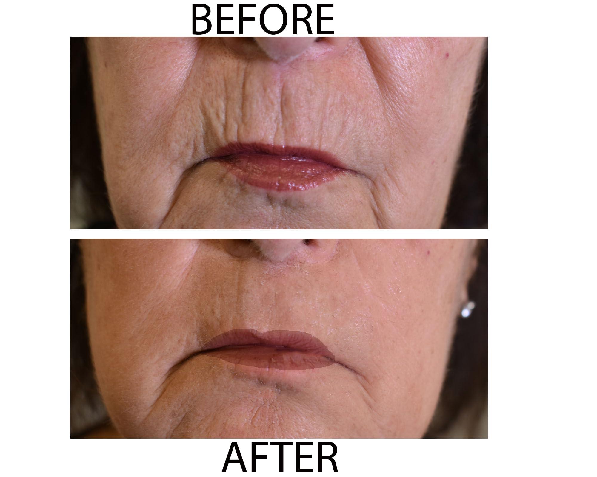 Dr.Sevinor Skincare Solutions Dr Sevinor Wrinkle Solution Wrinkle Smoothing Tinted Serum 1 FL OZ