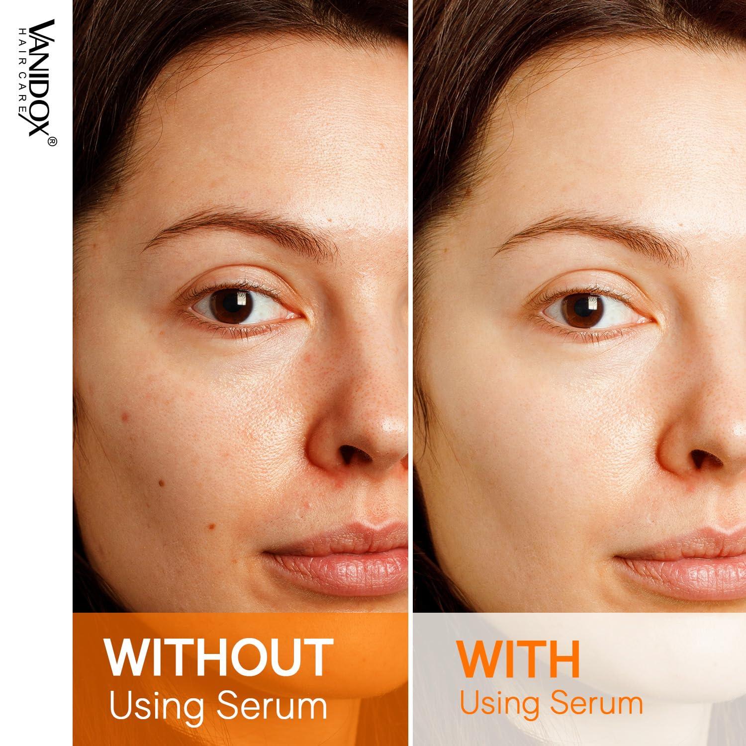 VANIDOX VANIDOX Super C Serum for Women Over 70, All-In-One Formula, Made in USA, Hydrates, Firms, Lifts, and Targets Wrinkles, Age Spots, and Fine Lines, Vitamin C Serum (1fl oz)