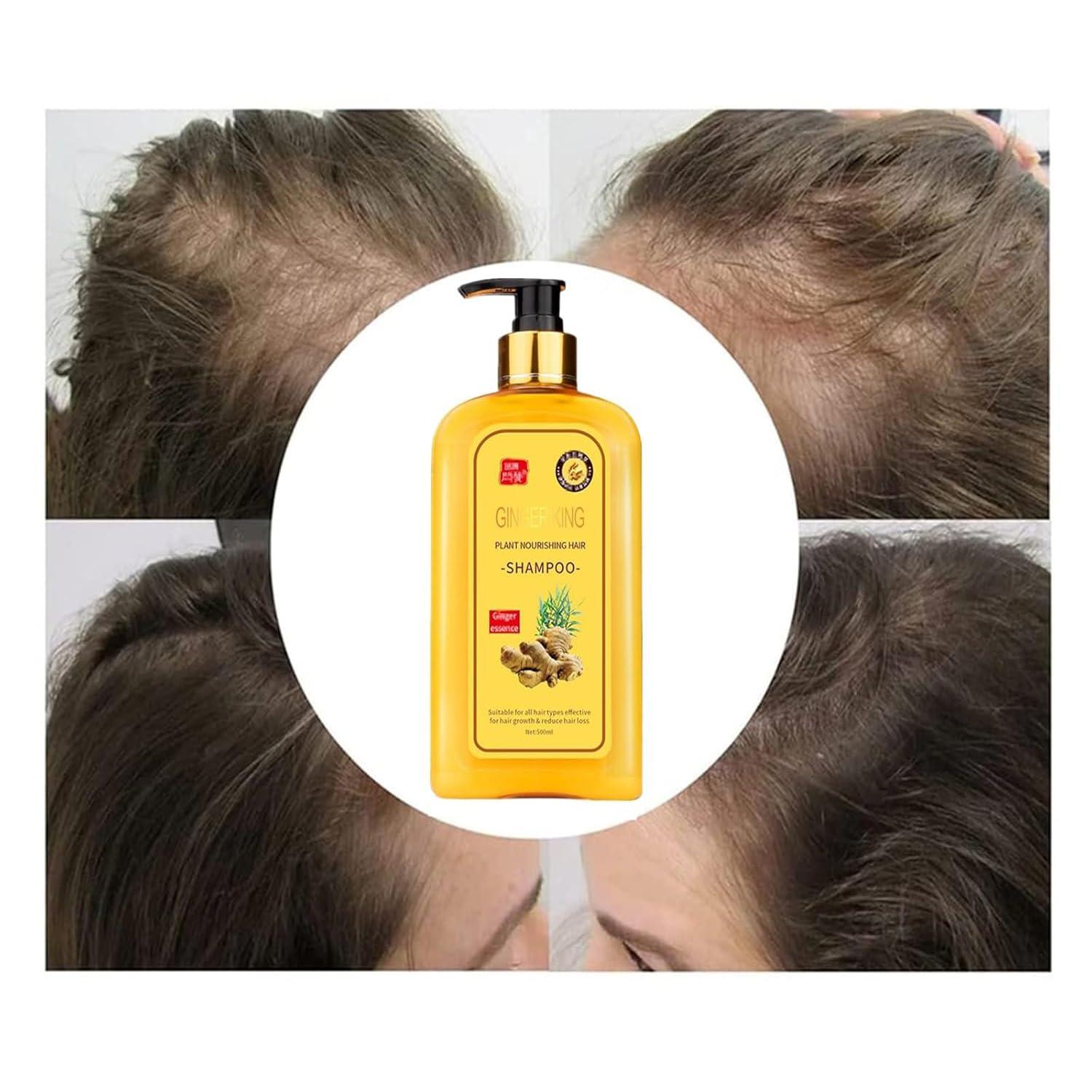 Lomnoeza Ginaday Instant Ginger Hair Regrowth Shampoo, Anti-Hair Loss (500ML/1PCS)