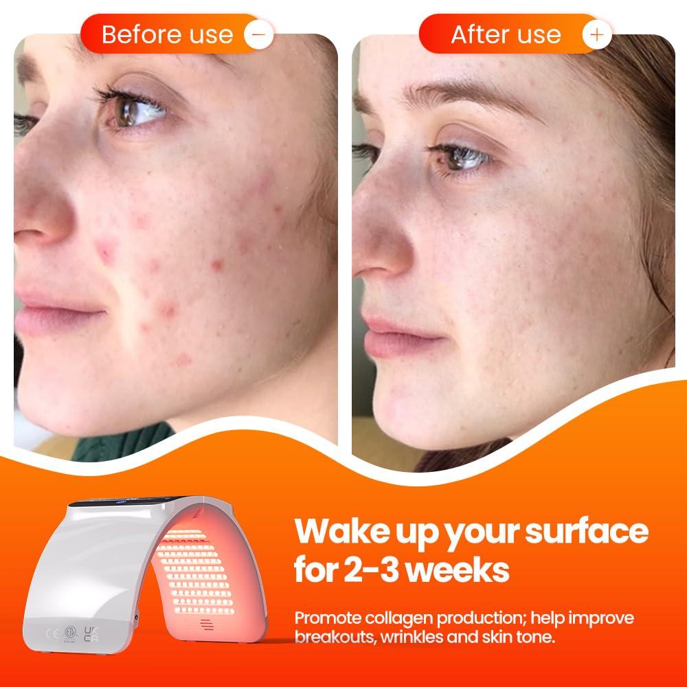 Bestqool Bestqool LED Mask Photon LED Light Therapy - 6 Colors with Near Infrared Light LED Face Mask for Skin Rejuvenation SPA Facial Body Skin Care Beauty Salon Device