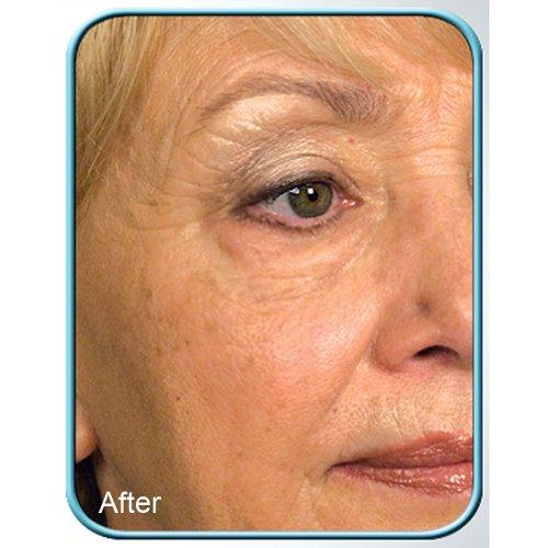 Biologic Solutions STEM CELL THERAPY CREAM BY BIOLOGIC 1oz JAR