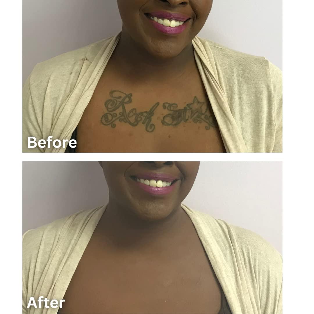 Dermaflage Dermaflage Tattoo Cover Up Makeup (Tan) - Bruise Full Coverage Concealer - Full Coverage Waterproof Concealer for Bruise, Scars & Acne - Smudge Proof Body Makeup Palette with 3 Pro SFX Shades + Brush