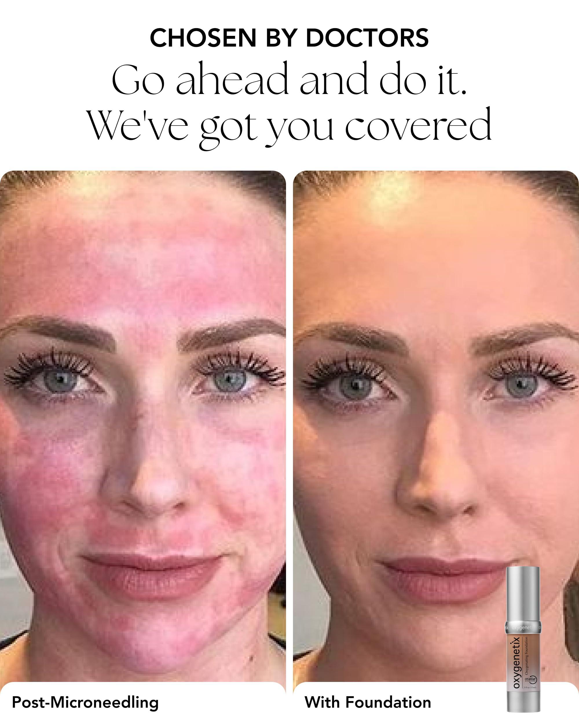 Oxygenetix Oxygenetix Oxygenating Foundation - 15ml - Almond