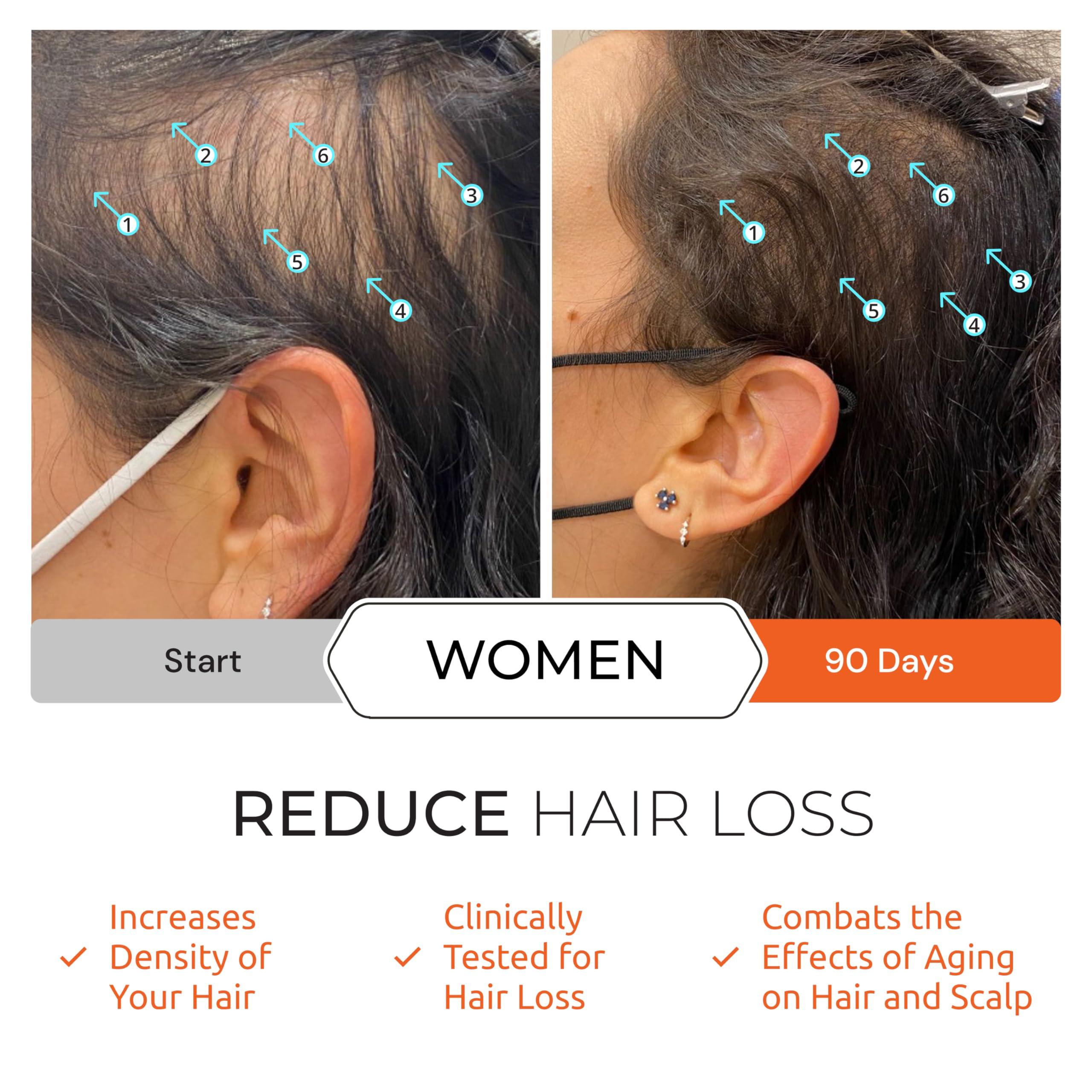 DS LABORATORIES DS Laboratories Revita Shampoo and Conditioner Set, Hair Thickening Shampoo and Conditioner to Support Hair Growth, Sulfate Free Shampoo and Conditioner with Biotin, Caffeine & DHT Blocker, Hair Care