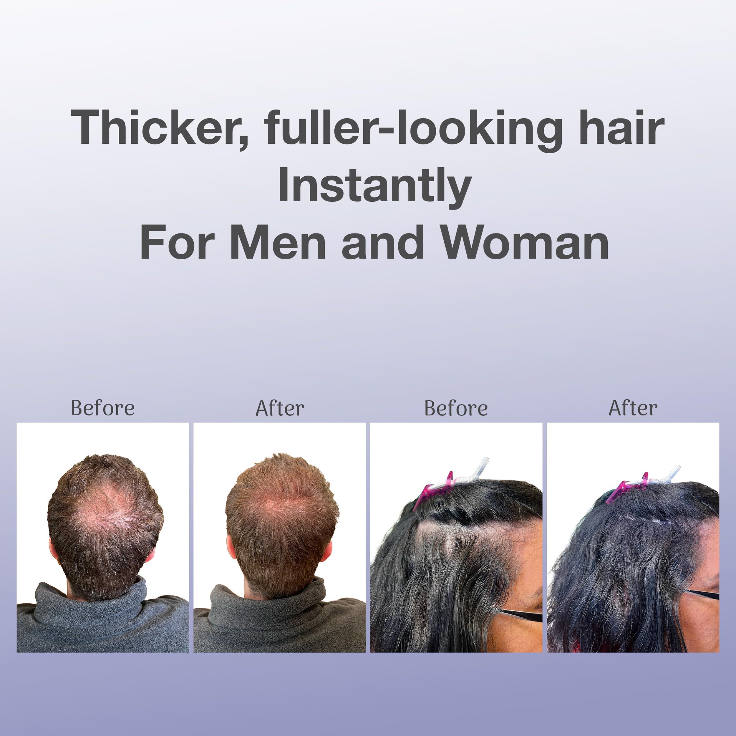 BosleyMD Bosley Professional Strength Hair Thickening Fibers, Dark Brown, 0.42 Ounce (Pack of 1)