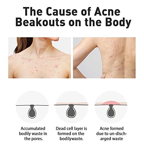 DASHU DASHU Daily Acne Relax Body Wash 16.9fl oz - Acne treatment, Cooling effect