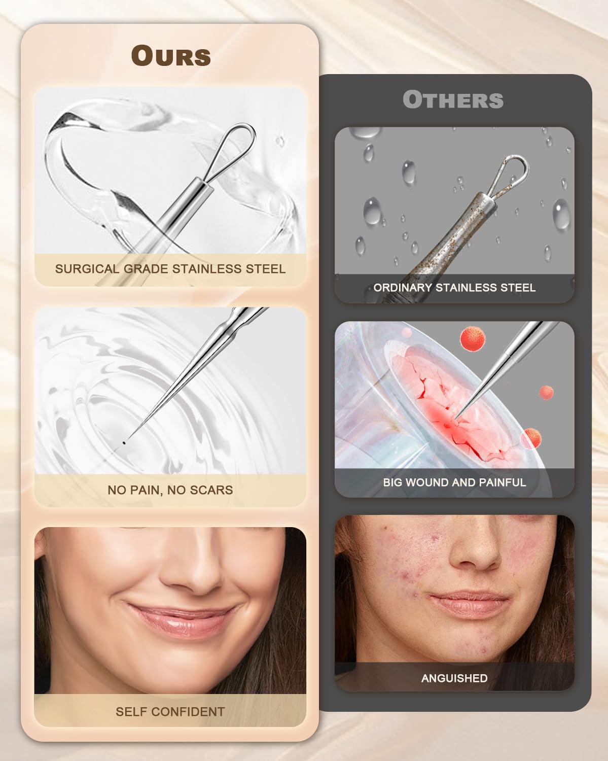 SG Nekoo SGNEKOO Professional Facial Milia Removal Tool and Whitehead Extractor,Titanium Alloy Double Ended Needle and Steel Tweezers Kit,Blackhead,Blemish,Zit and Pimple Acne Remover Popper (Titanium Gold)