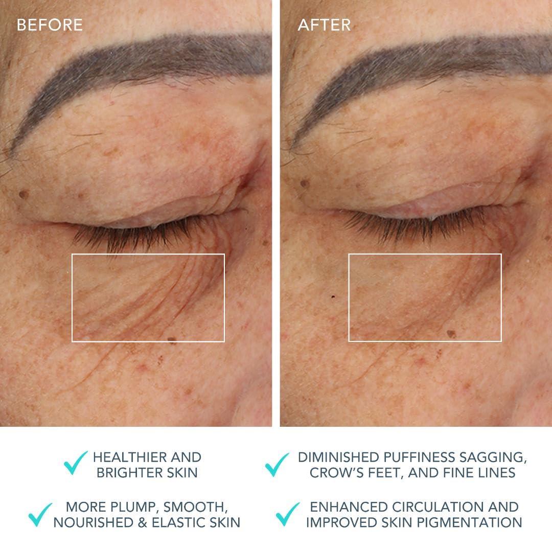 FOREO FOREO Bear Microcurrent Facial Device - Face Sculpting Tool - Instant Face Lift - Firm & Contour - Non-Invasive - Increases Absorption of Facial Skin Care Products - Mint