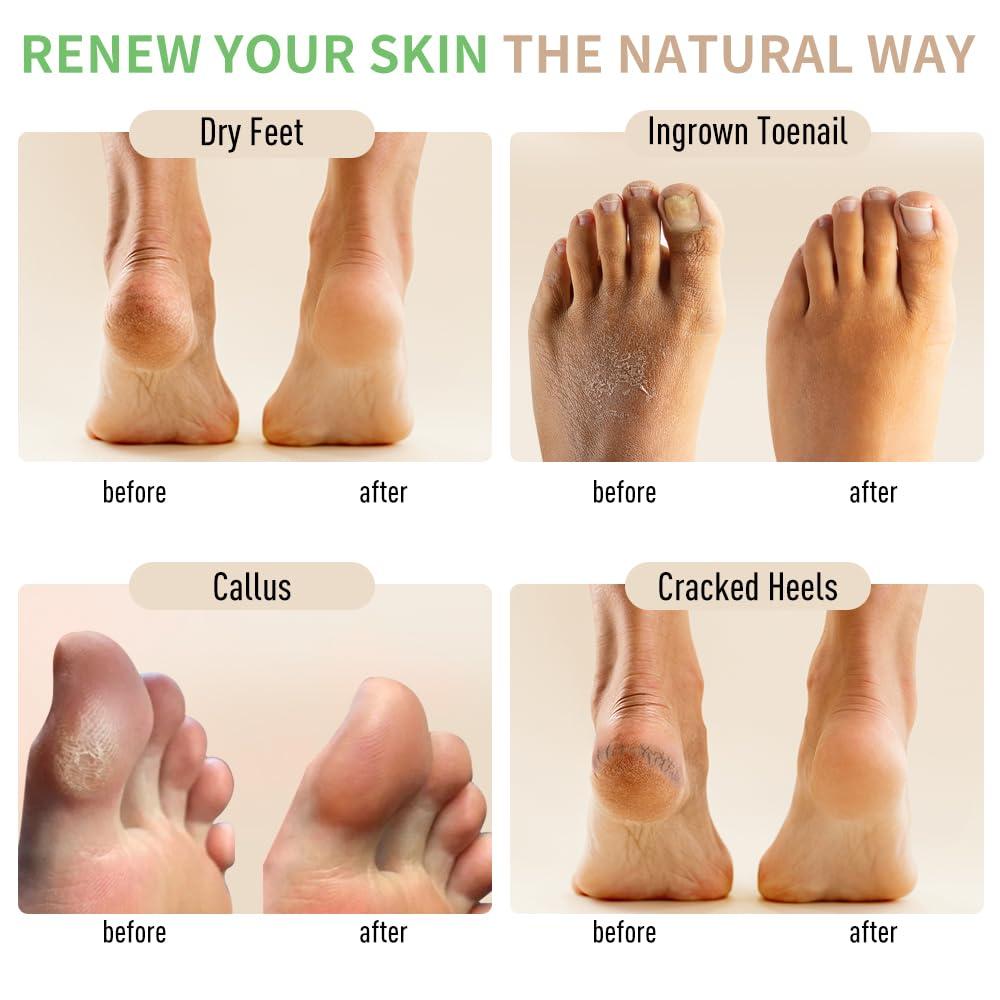 RIGHTMELL Natural Foot Soak Salt - Foot Treatment Soothes Athletes' Feet, Relieves Foot Odor and Ttchiness -9 Ounce