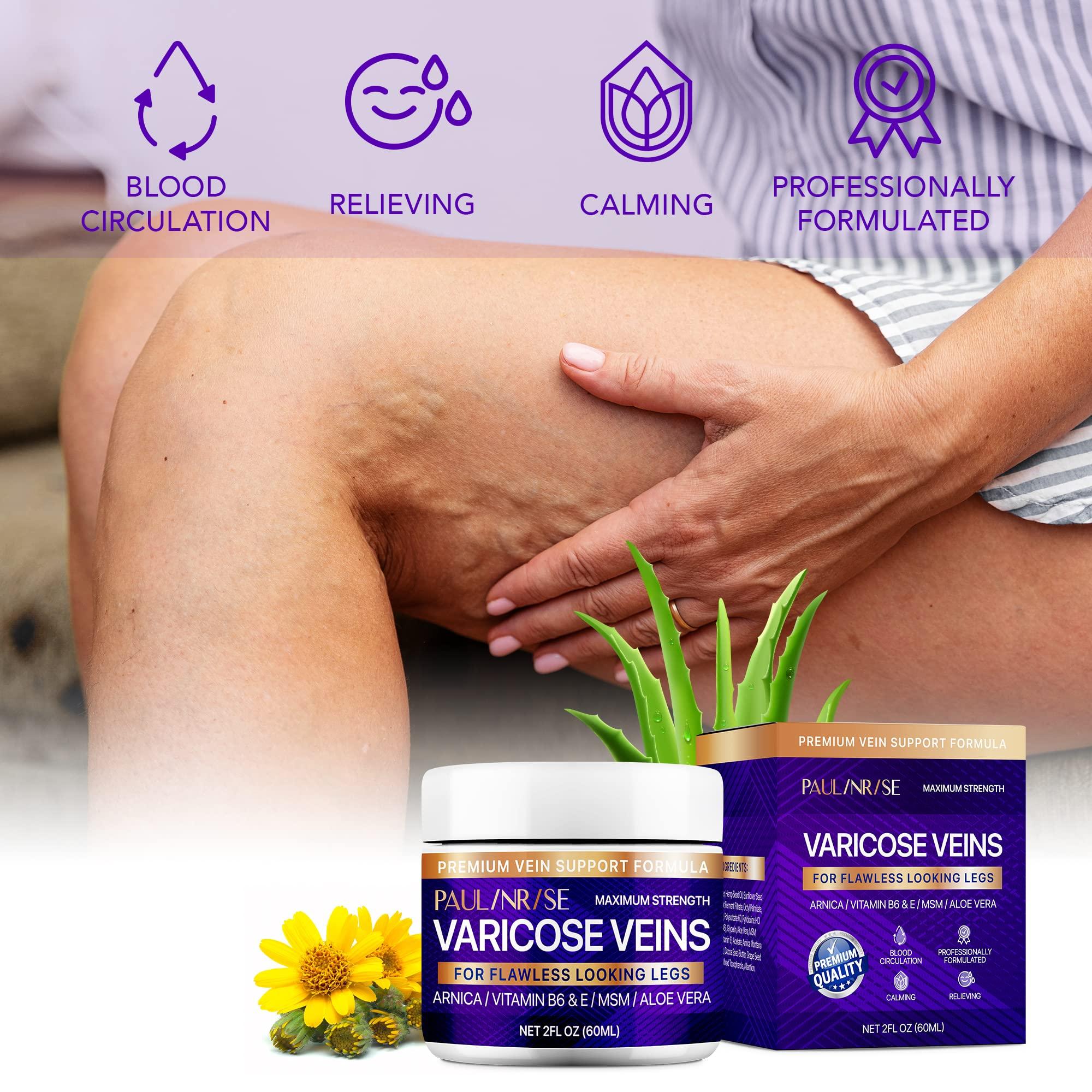 PAULINRISE PAULINRISE Varicose Vein Cream for Legs - Improves Blood Circulation, Reduces Spider Veins and Heaviness, 2 Oz