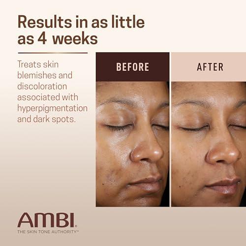 Ambi Ambi Even & Clear Advanced Fade Cream, Hydroquinone-free, Hyperpigmentation Treatment, Stubborn Dark Spot Corrector, Results In As Little As 2-3 Weeks, Niacinamide, Licorice Root Extract, PHA, 1 Fl Oz