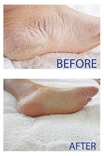 SMITH'S AMISH SMITH'S AMISH Foot Cream (4 oz.) Deep Soothing Herbal Cream for Intense Foot and Leg Discomfort including Burning, Cramping and Restlessness Sensations