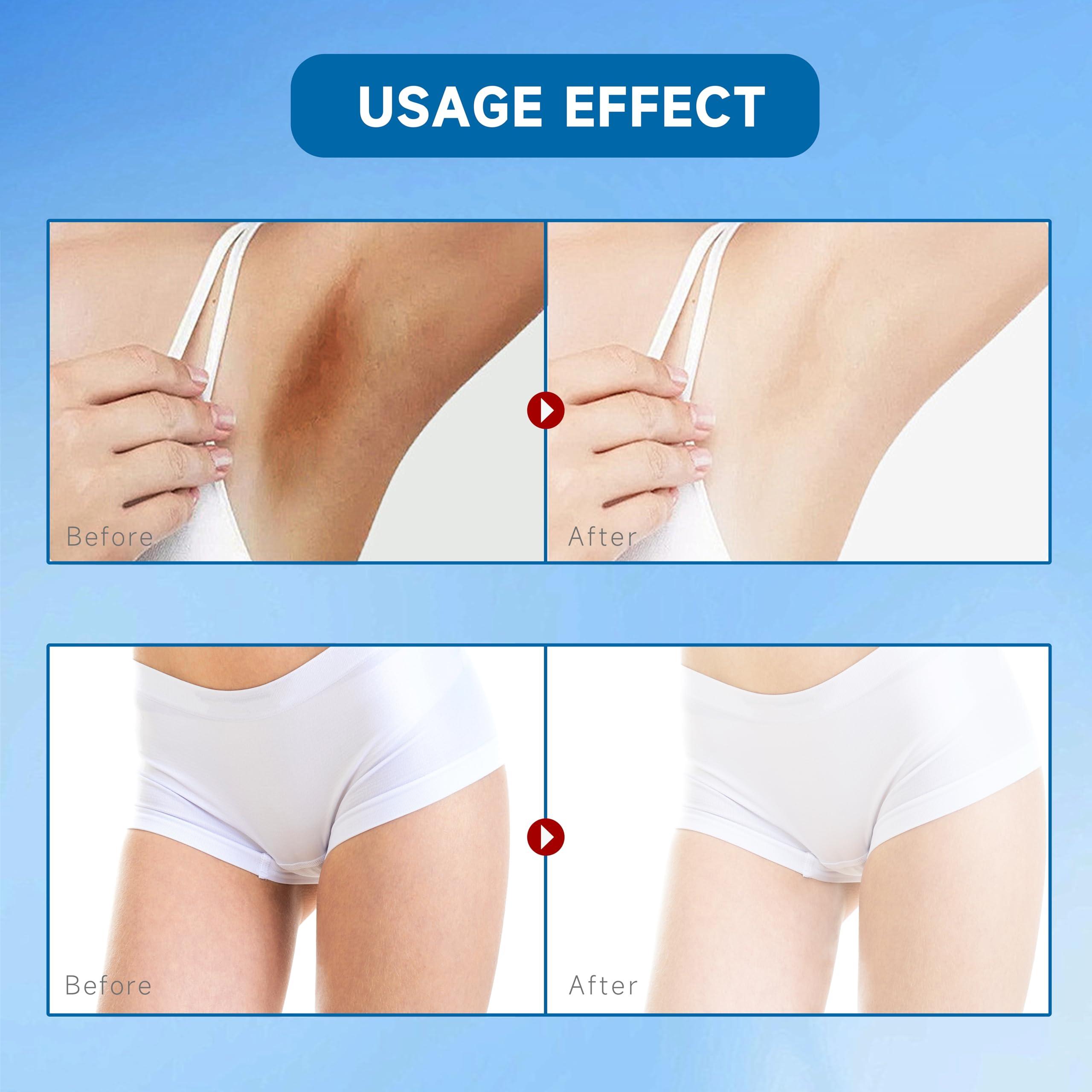 Nirraleza Skin Bleaching Cream for Body Intimate Areas, Skin Whitening Cream, Skin Lightening Cream, Dark Spot Remover for Private Parts, Underarms, Knees, Armpits, Elbows, Inner Thighs (1.7 Fl Oz) (1.7 Fl Oz)