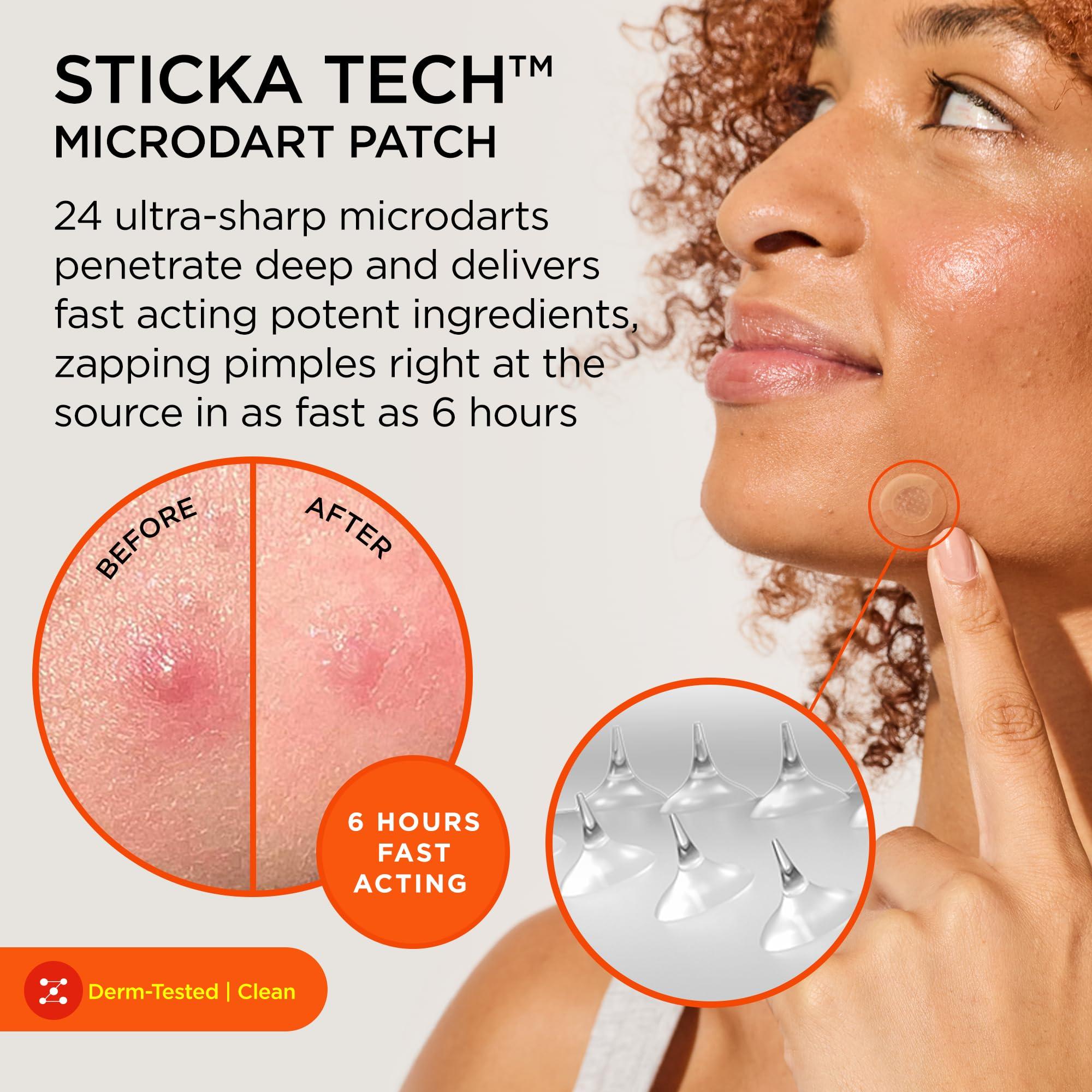 ZitSticka ZitSticka Killa Pimple Patches for Face - World\'s Most Potent Pimple Patch with Fast-Acting Microdarts - Starts Working within 2 Hours for Deep, Early-Stage Zits - 8 Count