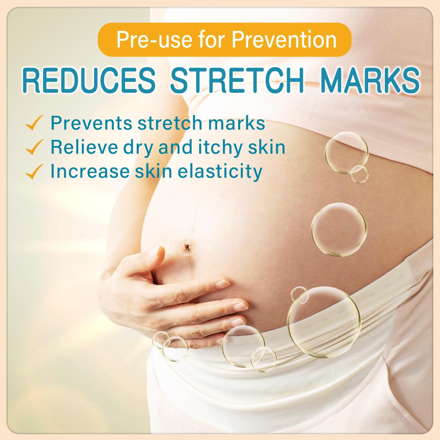 AOAO PEGO Stretch Marks Oil Maternity Body Oil for Stretch Marks Pregnancy Skin Care oil, Prevention & Reduction of Stretch Marks Pregnancy, 4.06 oz (2pcs)