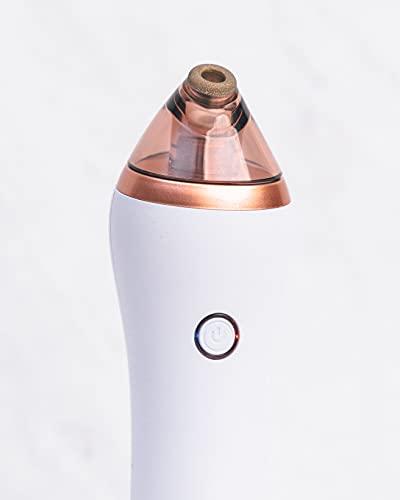 truDERMA TRUDERMA Microdermabrasion Machine – Professional Personal Microderm Abrasion Tool – At-Home Microdermabrasion Kit with 4 Heads – Dermabrasion Facial Machine for Bright and Smooth Skin (White)