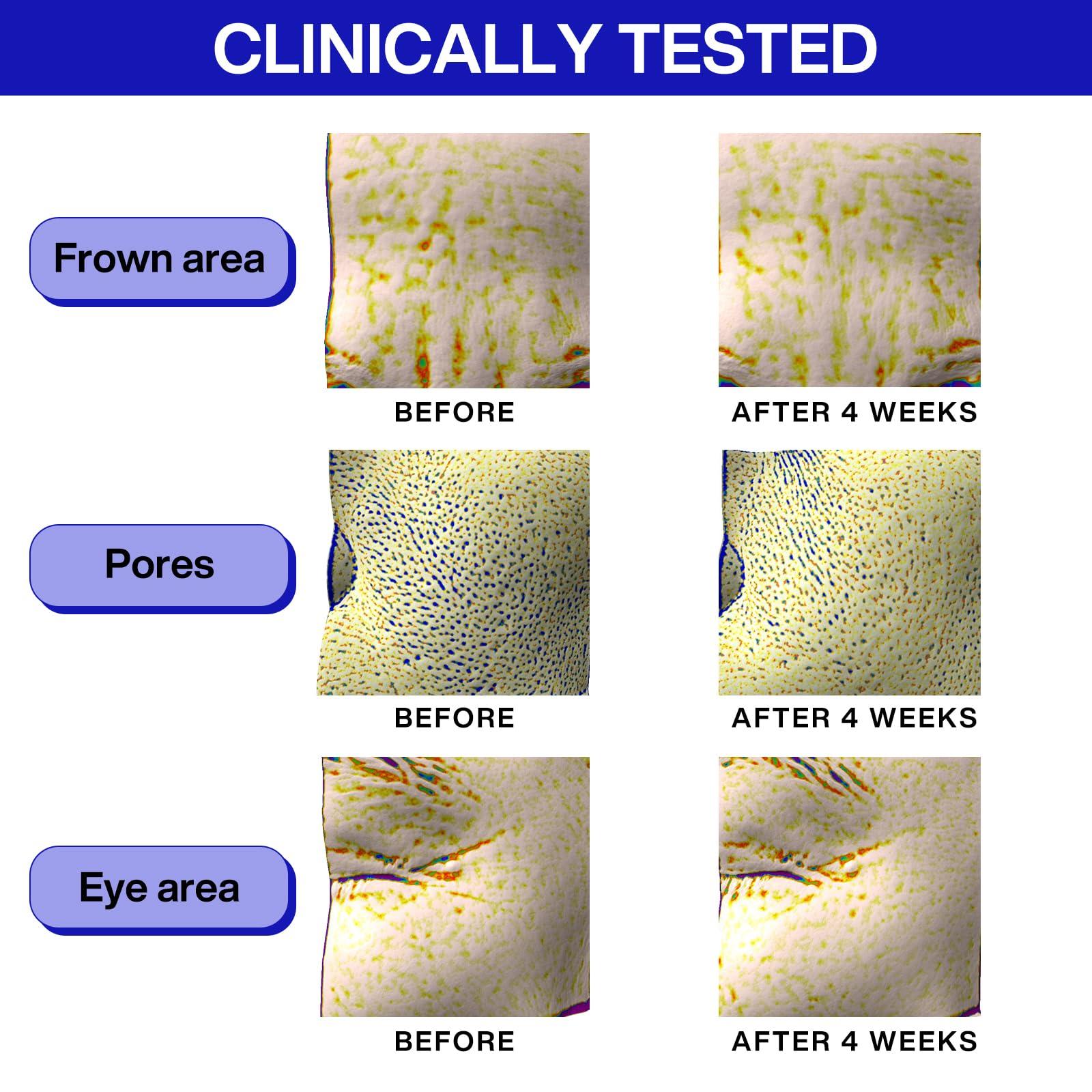 IOPE IOPE Retinol Super Bounce Serum - Korean Retinol Eye Cream, Intensive Reactivating Korean Retinoid, Anti-Aging, Reduction in Fine Wrinkles, Beginner Friendly, 1.01 Fl Oz.