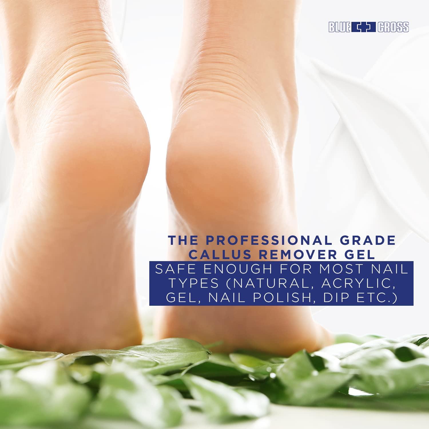 Blue Cross Blue Cross Callus Remover Gel for Feet or Heel, Extra Strength Professional Nail Care, File, Shaver, Scrubber & Pumice Stone Alternative for at Home Manicure/Pedicure Results, 16oz
