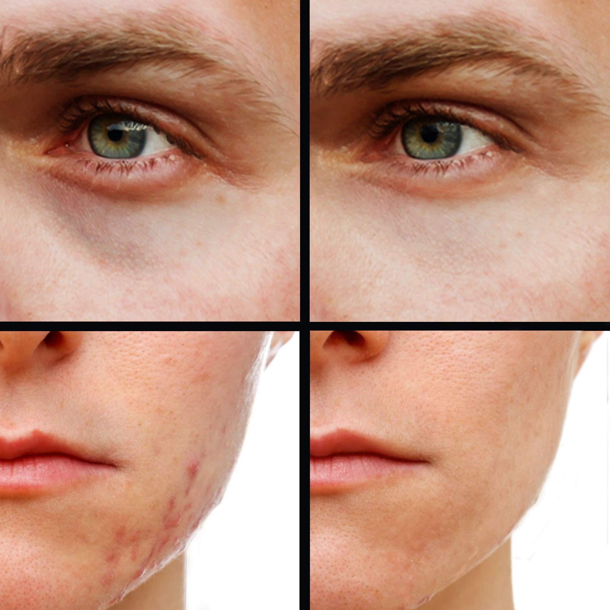 KODE Mens KODE Mens Concealer (Lightest) Dark Circle Under Eye Cream Corrector, Multi-Use, Pimples, Scars, Rashes