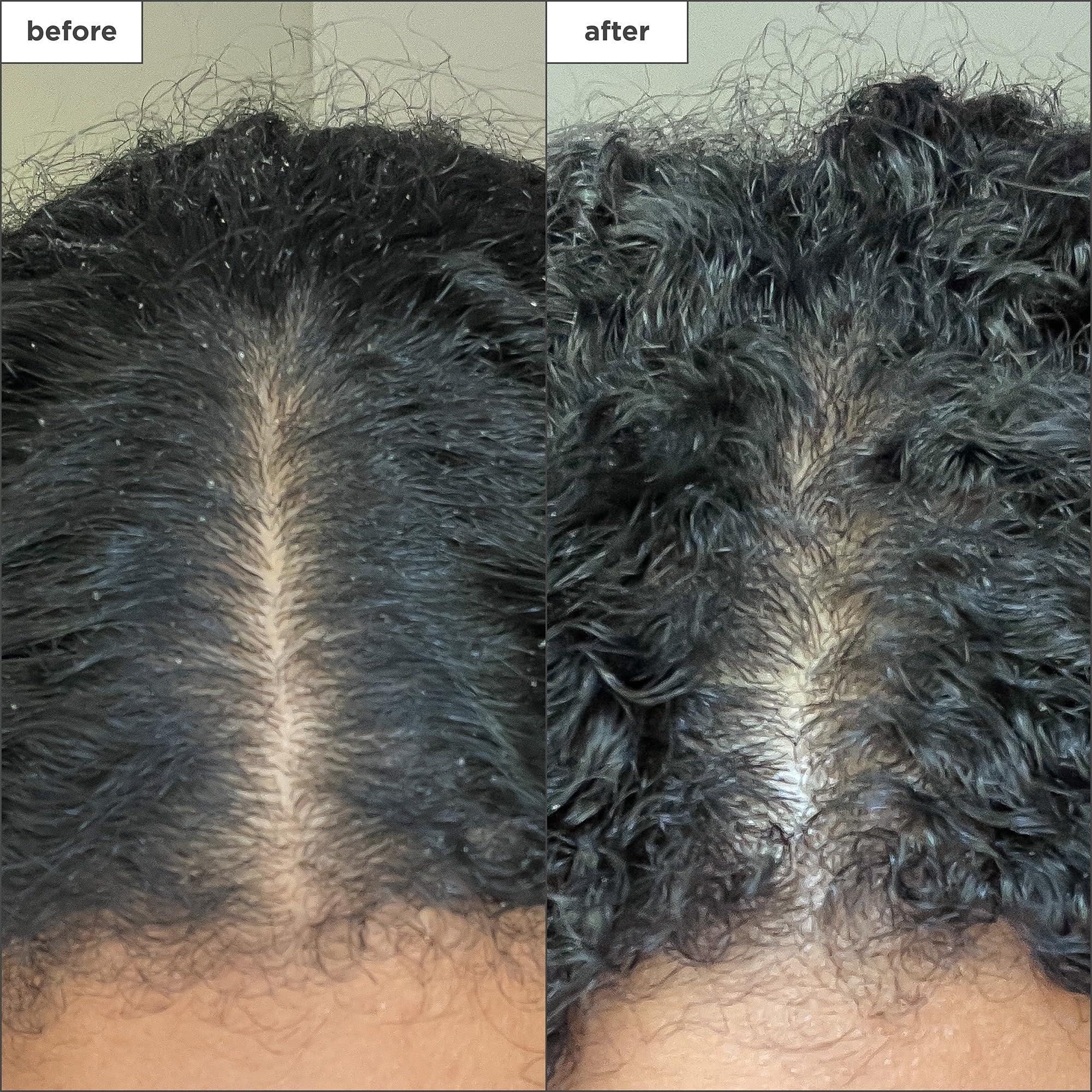 Briogeo Briogeo Scalp Revival Charcoal + Coconut Oil Micro-Exfoliating Shampoo, Treatment for Dry & Itchy Scalp, Clarifying Shampoo for Build Up, Scalp Scrub for Oily Scalp, Vegan, Cruelty-Free, 8 fl oz