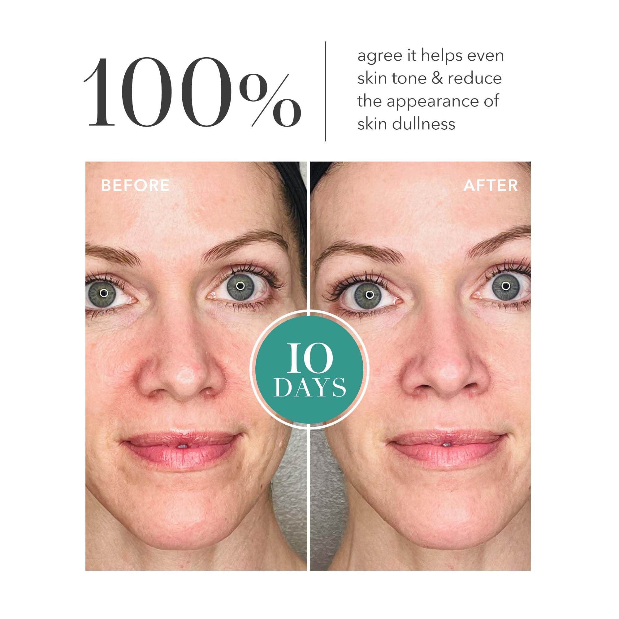 Algenist Algenist GENIUS Liquid Collagen Essence - Liquid Collagen Serum with Patented Alguronic Acid to Help Improve Skin Bounce, Elasticity & Radiance (100ml)