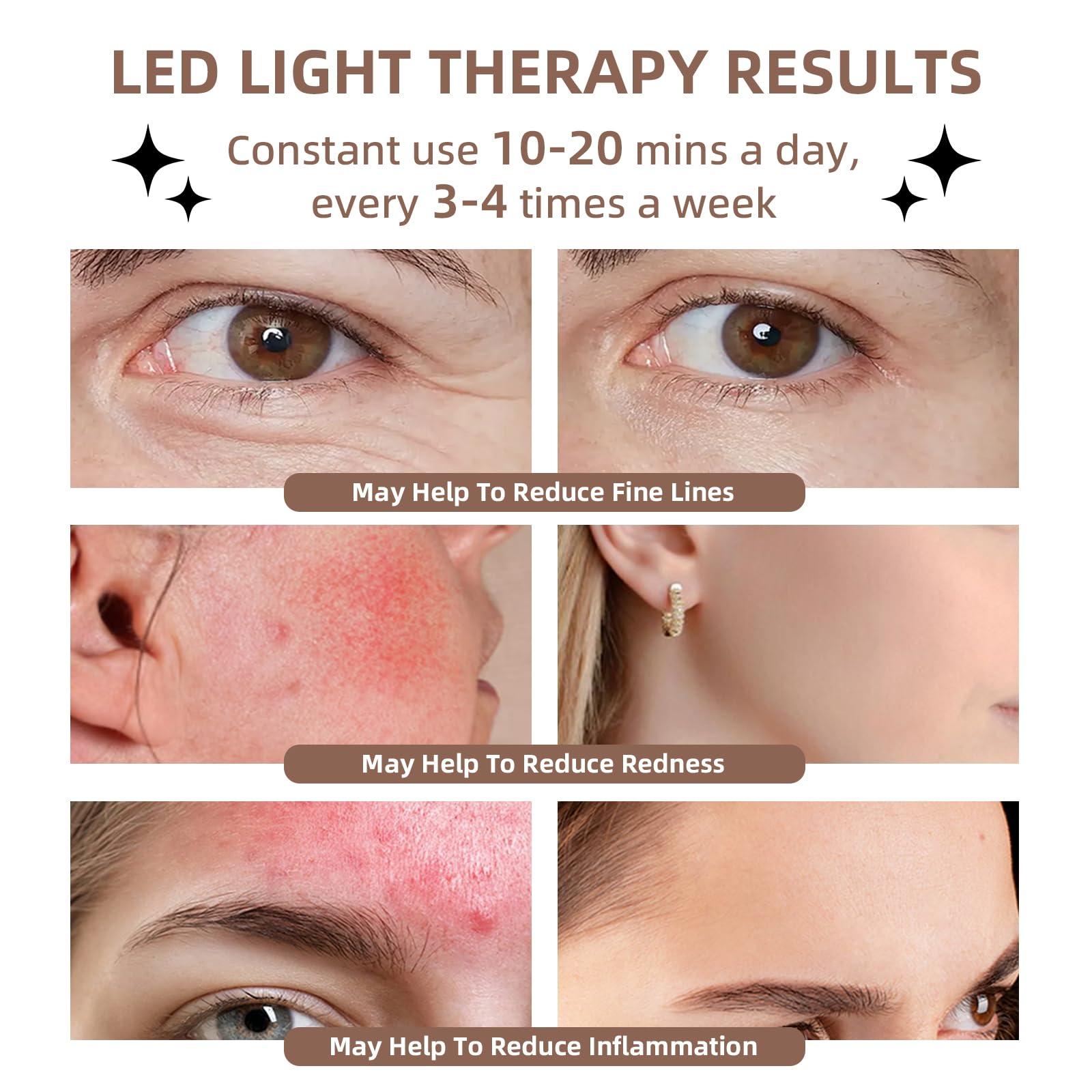 PAIM NRE LED Light Therapy Facial Mask, Multi Color LED Face Mask, Portable Red Light Therapy Mask, Home and Travel Skin Care