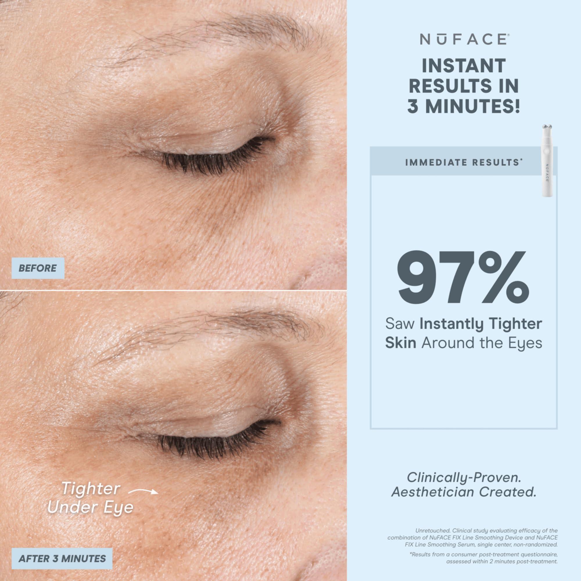 NuFACE NuFACE FIX Line Smoothing Starter Kit - FDA Cleared Microcurrent Device + Serum Activator for On-The-Go Treatment of Forehead Lines, Crow\'s Feet, Under Eyes, Smile & Fuller-Looking Lips