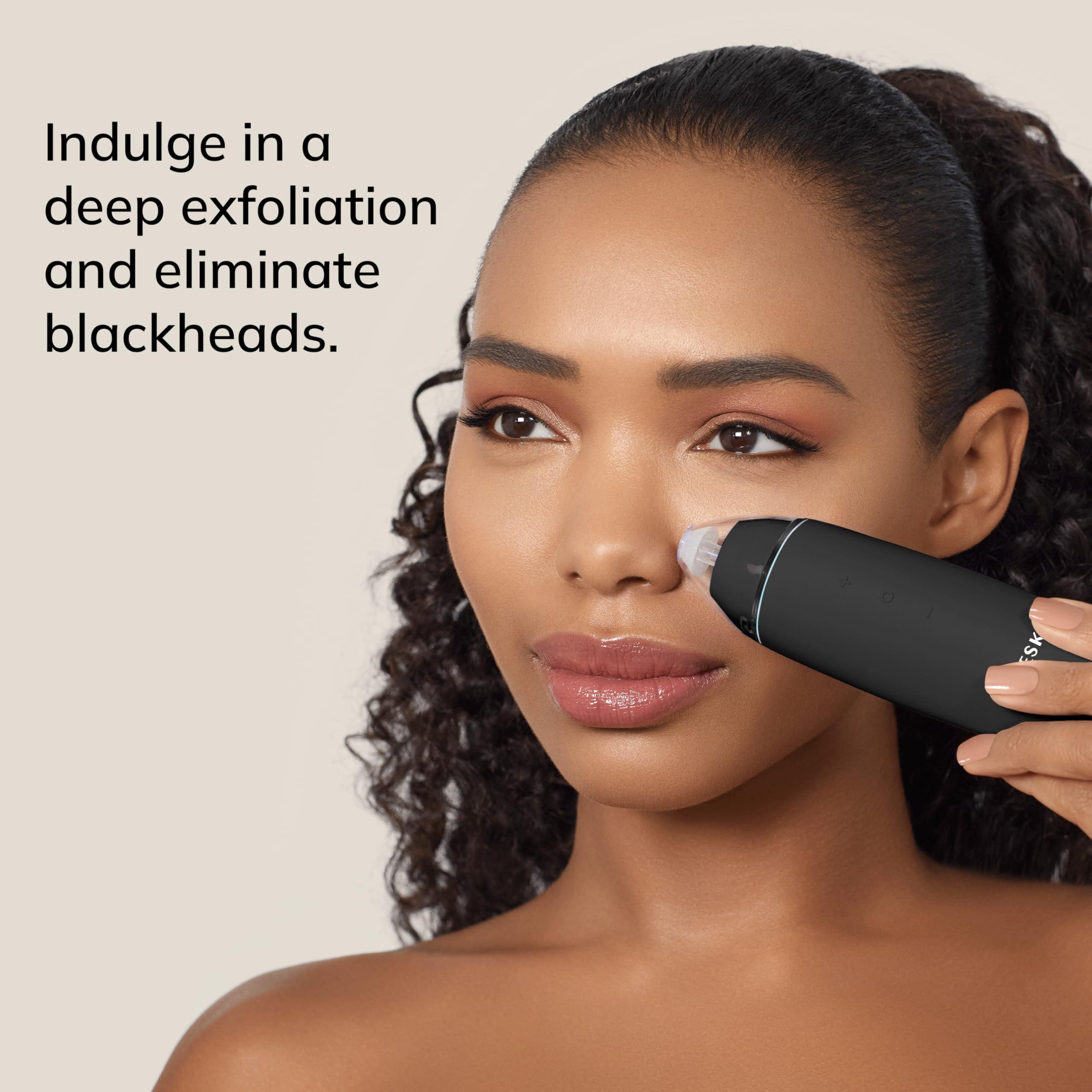 GESKE GESKE SmartAppGuided MicroDermabrasion Blackhead Remover | 7 in 1 | Blackhead Remover | Electric Pore Cleaner | Innovative Vacuum Cup | Beauty Tool | Skin Cleansing Device | Skincare Device