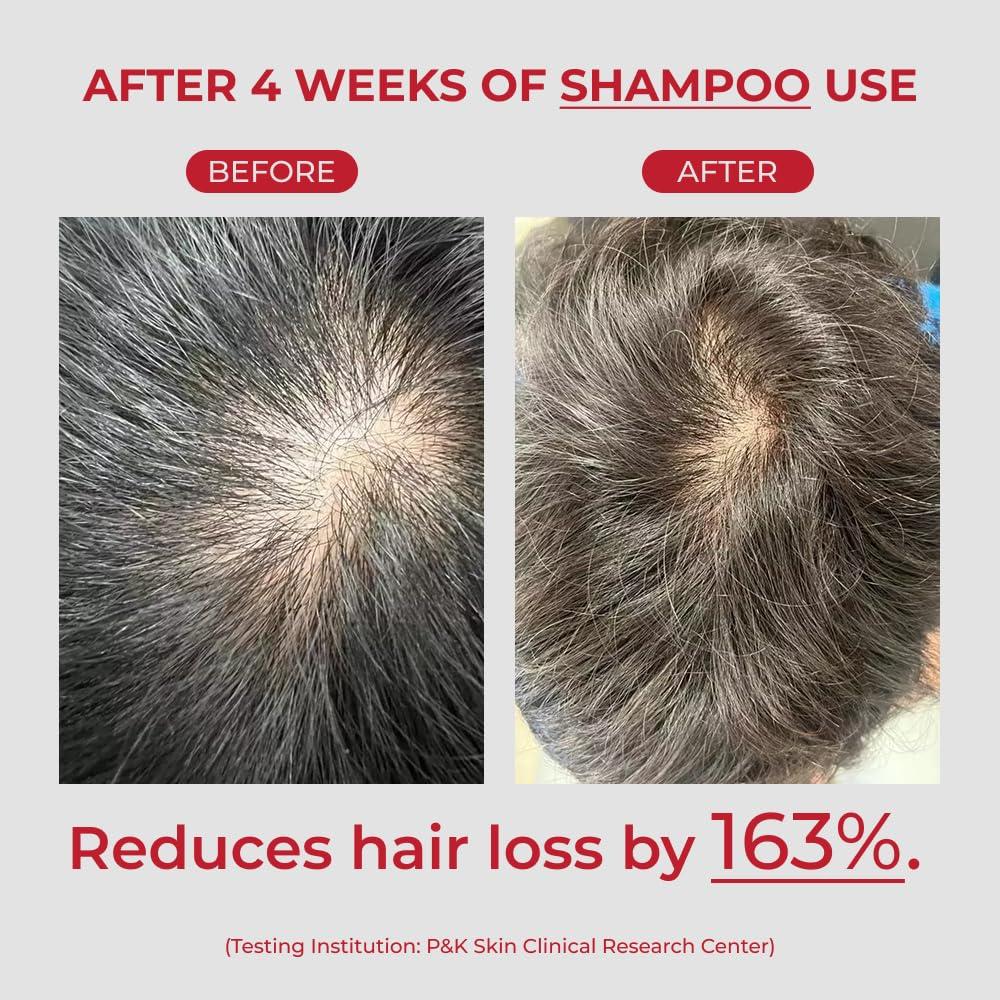 MOEV MOEV ANNURCATIN Shampoo and Conditioner Set for Women, Korean Biotin Hair Growth Volumizing Shampoo, Paraben-Free Natural Apple Wash-Off Hair Mask, Rose Thickening for Damaged Hair